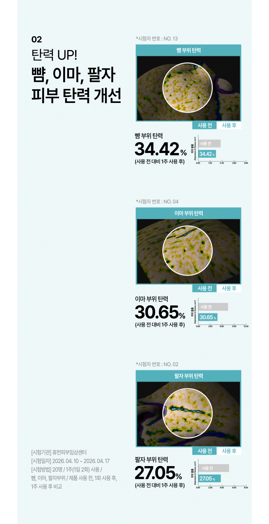 6-2.아디포사 임상_2(크림만)